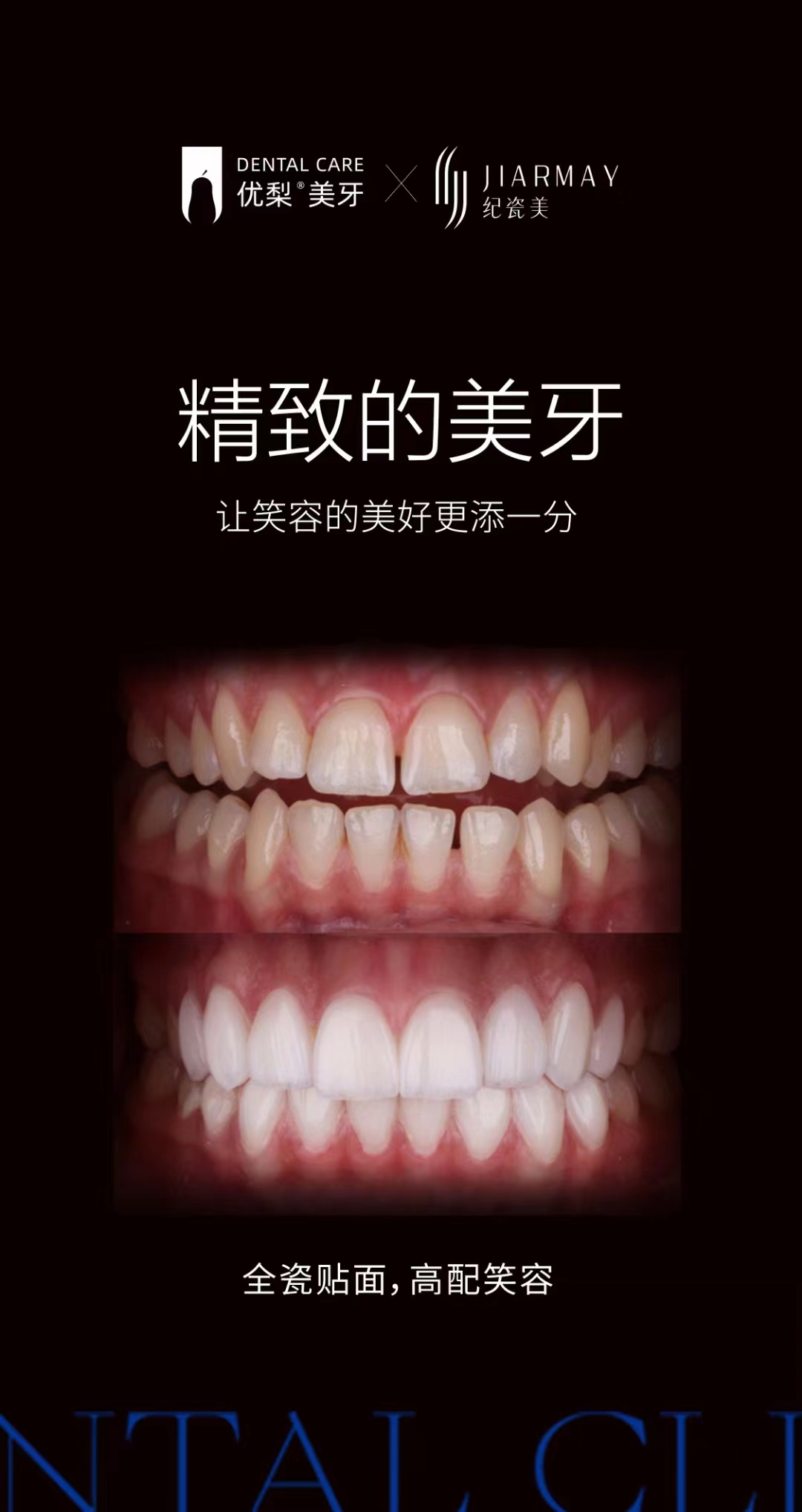 定西美牙全瓷贴面培训推荐机构